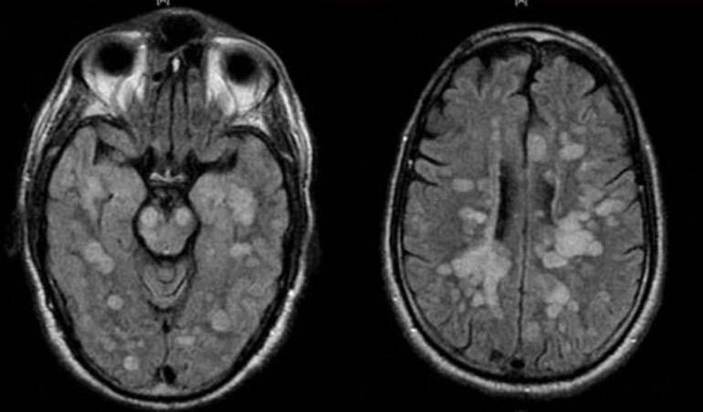 abdde koronaviruse yakalanan cocuk felc oldu 0 Büyükşehir’de Yılın Son Meclis Toplantısı Gerçekleştirildi!